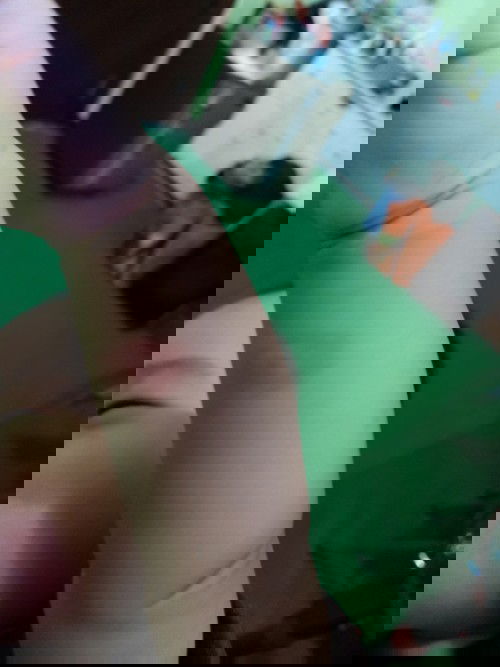 Luka di tangan si kecil