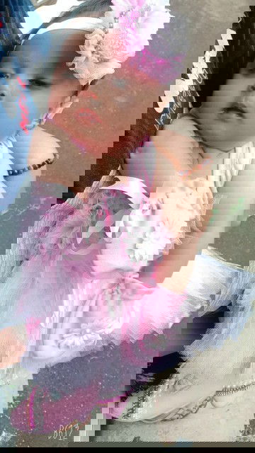 Bunda2 dsni kalo puting susu lecet, bunda apain??bagi ilmunya dong..