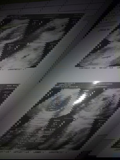 Bundaaa tolong kasih solusi🙏🙏😭😭