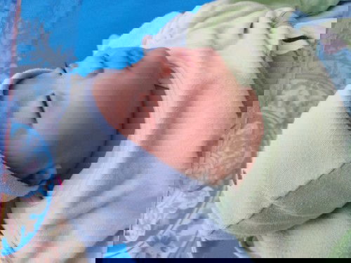 ผิวหน้าแห้งในฤดูหนาว