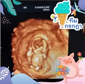 แพ้ท้องงงง