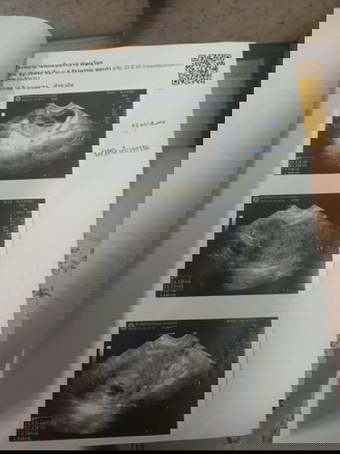 ขอสอบถามหน่อยจร้า