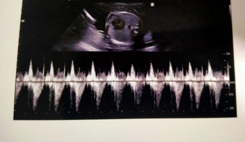 21W 4D หมูน้อยของหม่าม๊า