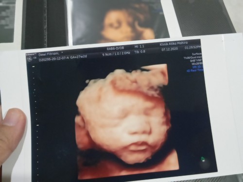 Baby boy pakai diapers, itu bagaimana??