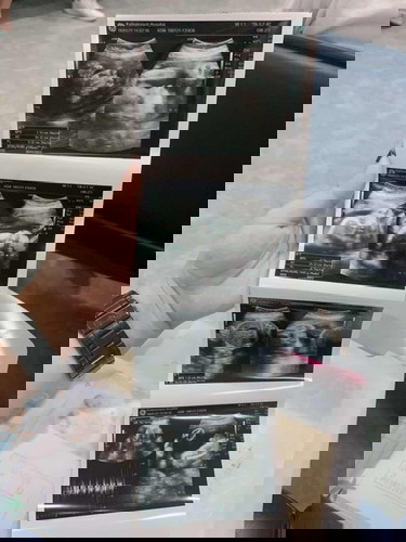 เด็กอ้วนนนน🥰❤️😖