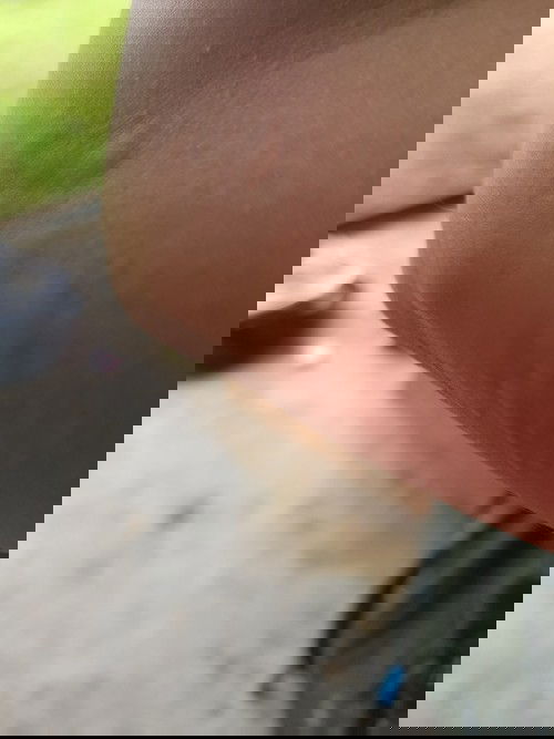 Selamat pagi & salam sejahtera ibu²..
Ada tak yang time preggy kena alergic?? xtau kena alergic apa