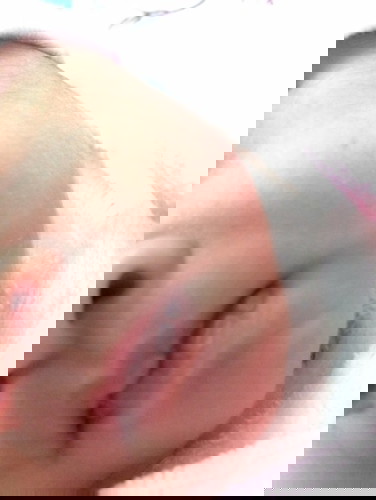 แบบนี้แรกปากพองไหมคะ