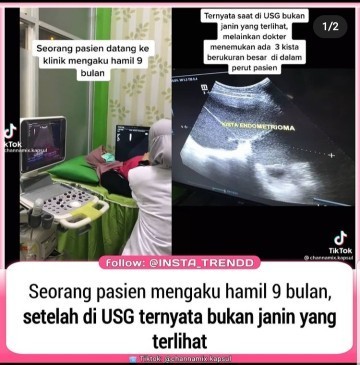 WARNING! USG itu penting!!