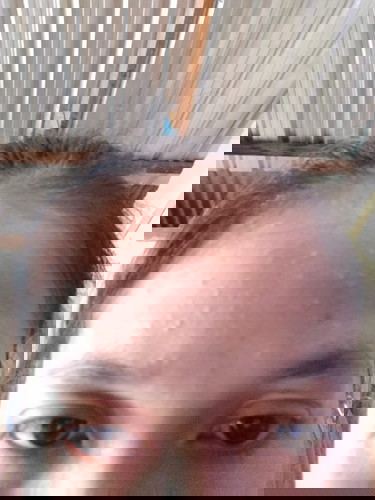 แม่ๆแนะนำหน่อยจ้าสิวบุกหนักมากใช้ว่านหางกับมะเขือเทศก็ไม่ลดเลยค่ะ