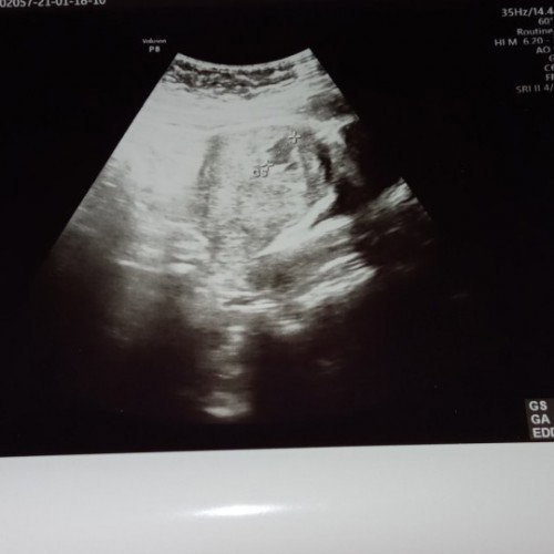 10w3d masih kantung