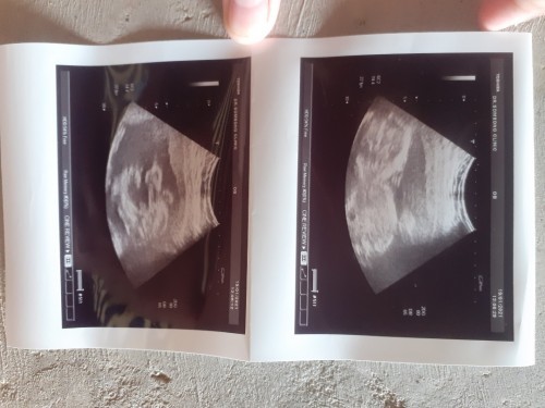 สอบถามคุณเเม่หน่อยค่ะ