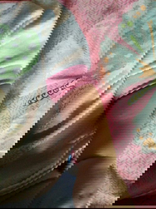 Benjolan di payudara