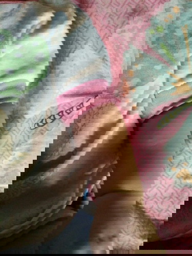 Benjolan di payudara