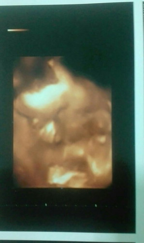 ความผิดพลาดที่แสนงดงาม💗💗