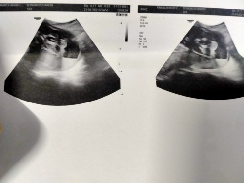 คุณพ่อนี่ดีใจสุดค่ะลูกชายคนเล็ก ผมมีพี่สาว3คนครับ #ความหวังเป็นจริง