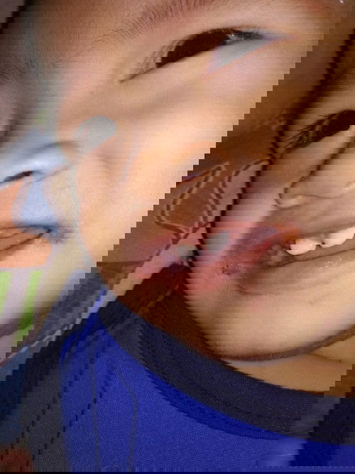 Mga mommies, ano po kaya ito? saka anong pwedeng gamot para dto?