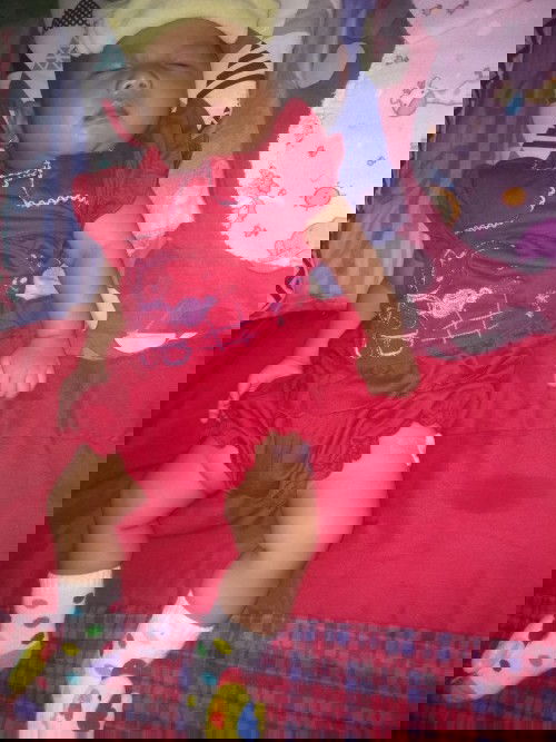 Demam sehabis imunisasi