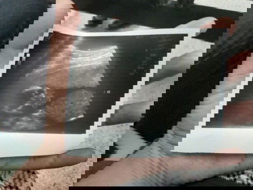 ท้องแรก ได้ยินเสียงหัวใจลูกครั้งแรก!! ตื่นเต้นจัง 🥰