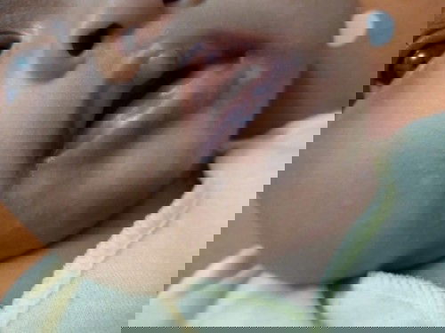 Bercak putih diwajah