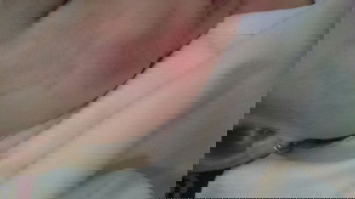 Bé 3 thág 15 ngày da mặt bị như vậy phải làm sao đây các mom