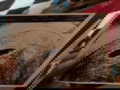 สอบถามแม่ๆค่ะ