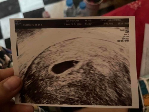 สอบถามแม่ๆค่ะ