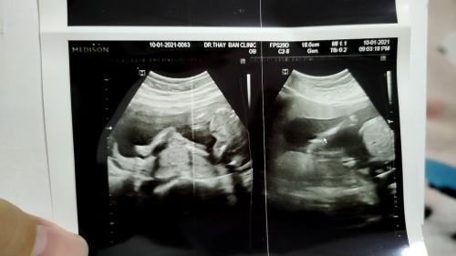 ลูกสาว🥰🥰