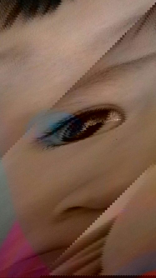 แม่ๆคะ น้องบ้านไหนเคยเป็นแบบน้องไหมคะ ?