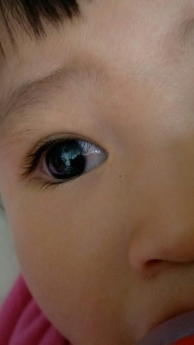 แม่ๆคะ น้องบ้านไหนเคยเป็นแบบน้องไหมคะ ?