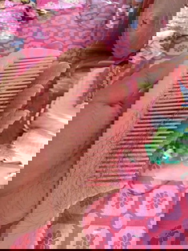 คลอดลูกเเบบผ่าตัด