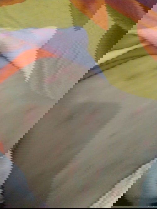 Gatal pada bayi 5 bln