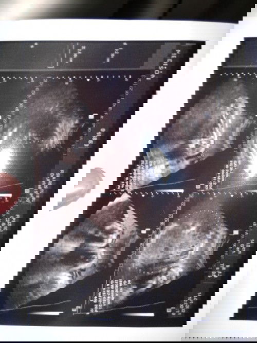 Nanya tentang Kehamilan