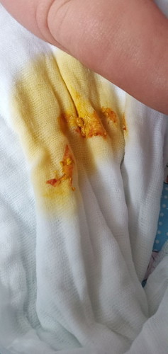 7days pa lang baby ko,tanung lang mga moms if ok lng ba to pupu nya yellow and may medyu red, hirap