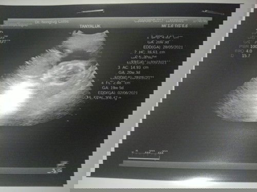 ได้ลูกสาวคลอดเดือนมิ.ยจ้า