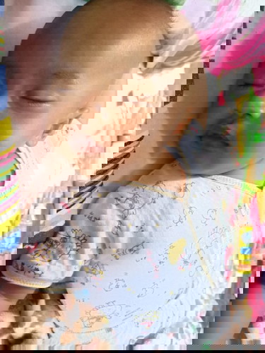 Putih2 di jidat menyerupai panu