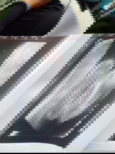 เพศอะไรนร้า