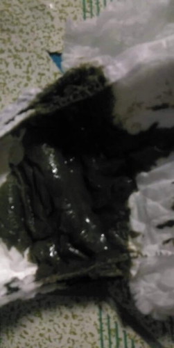Dark green poop