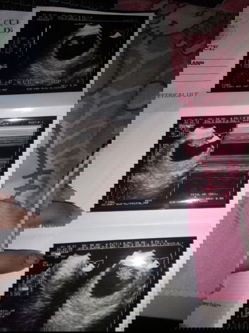 My little patootie😘😘😍😍