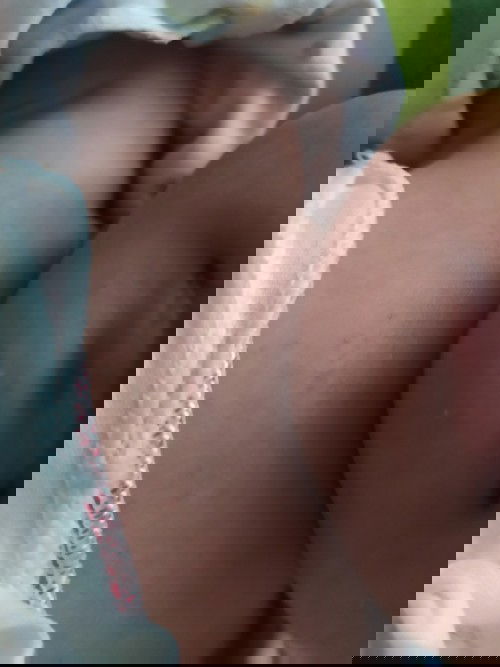 Merah bintik bintik di badan