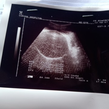 34weekไปซาวด์