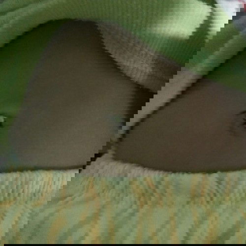 warna putih pada pusar bayi umur 7 bulan