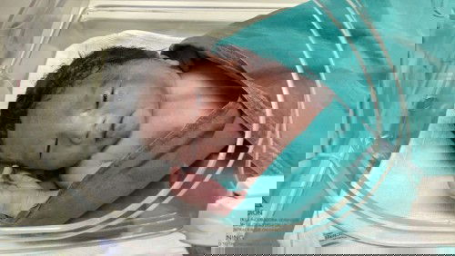 แตกแล้ว แม่ผ่าคลอด แต่ตัวน้อย มีอาการติดหายใจเร็ว แม่กังวลมากค่ะ