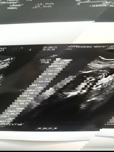 คุณแม่ลูก2