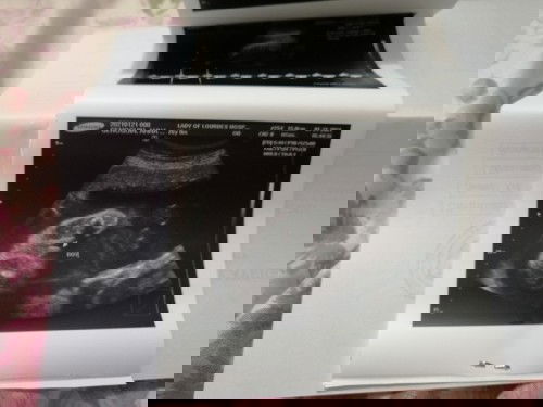 BOY first ultrasound ❤️