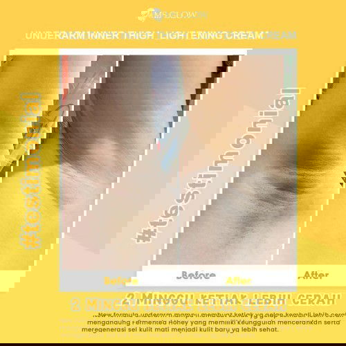 cara mengatasi LIPATAN HITAM, DI KETIAK,LEHER,SELANGKANGAN DLL