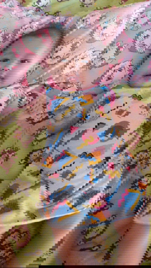 Bayi 4 bulan stngah belum bisa tengkurep.