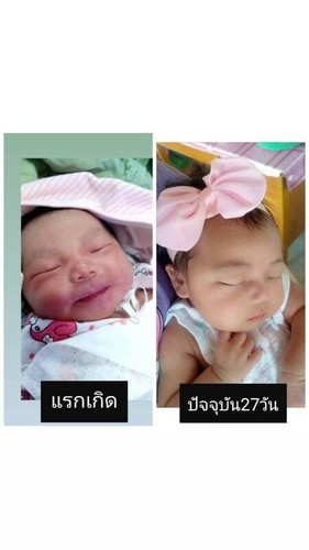 ขอดูรูปลูกแม่ๆตอนแรกเกิดกับปัจจุบันหน่อยค่ะ