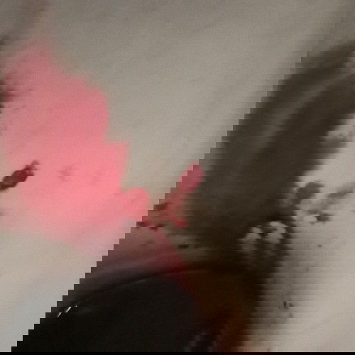 ท้อง33w4Dมีเลือดออก