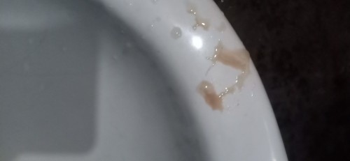 Brown diacharge ba???