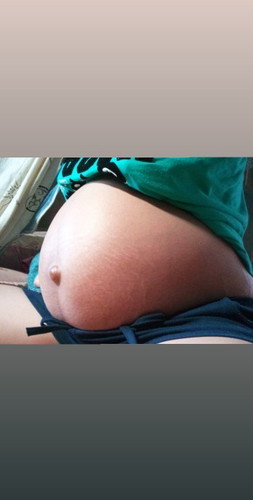 35วีค
แม่ๆกำหนดคลอดเดือนไหนกันค่ะ
#ทีมผ่าคลอด